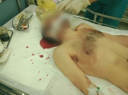 На Киевщине порезали ножом таксиста: мужчина в реанимации