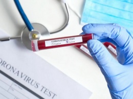 В Нацслужбе здоровья рассказали, почему не стоит делать тесты на антитела к коронавирусу