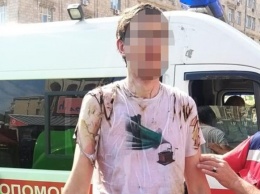 В центре Киева мужчина облился неизвестным веществом и поджег себя