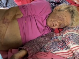 Жила месяц на улице не двигаясь: в больнице Запорожья умерла избитая бабушка