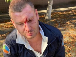 В Киеве избили инспектора по парковке за замечание