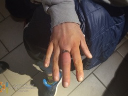 Жительнице Кривого Рога, чтобы снять кольцо понадобилась помощь спасателей