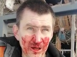 Кузбасского экоактивиста избили в присутствии бывшего депутата