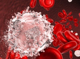 Симптомы "смерти": обнародованы новые признаки рака крови