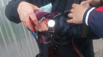 Во время траурного митинга на Куликовом поле активисту оторвало палец