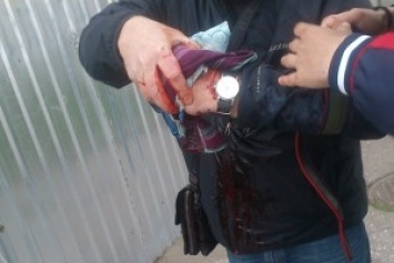 В Одессе в руках участника траурной акции взорвалась лампадка