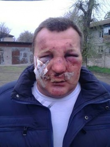 В Запорожской области на глазах у жены жестоко избили члена "Радикальной партии"