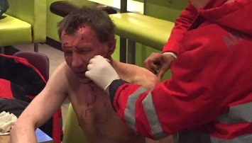 Ночью в кафе Киева окровавленный мужчина заявил о покушении