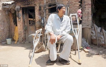 Самый высокий китаец пройдет операцию, которая позволит ему ходить (фото)