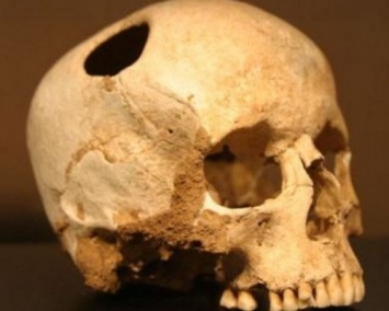 Ученые: На юге РФ нашли черепа древних людей переживших ритуальную трепанацию