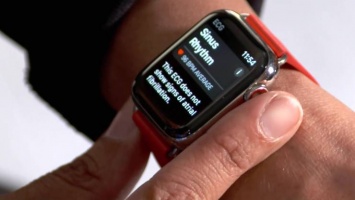 Как активировать приложение ЭКГ на Apple Watch Series 4 в России