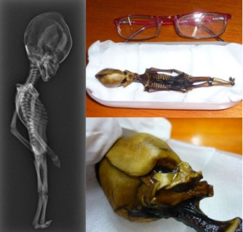 Таинственный скелет инопланетянина из пустыни Атакама оказался человеческим. Фото