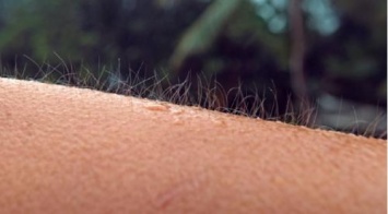 Ученые: Мурашки на коже могут ускорять рост волос