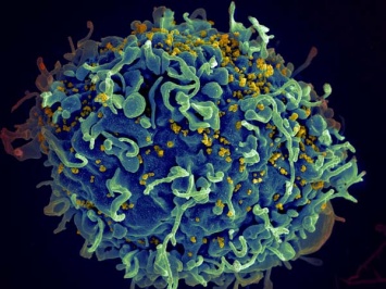 Вакцина против ВИЧ смогла излечить нечеловекообразных приматов