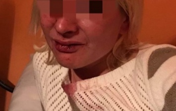 Житель Закарпатья избил работницу и посетителей кафе