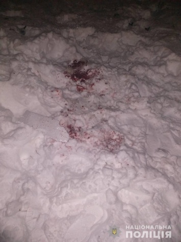 В Харькове мужчине оторвало кисть руки, когда он запускал фейерверки