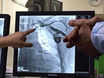В Полтаве сделали уникальную операцию на сердце (фото)