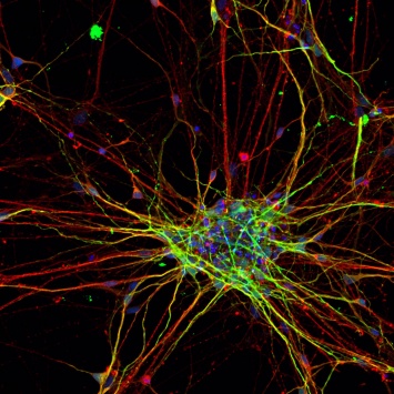 Показано, что нейроны у людей с аутизмом растут иначе