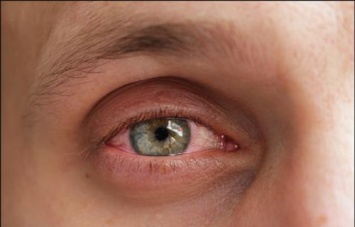 Виагра может повредить сетчатку глаза