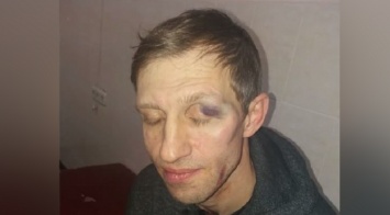 Избиение физрука в Киеве: появились фото избитого учителя