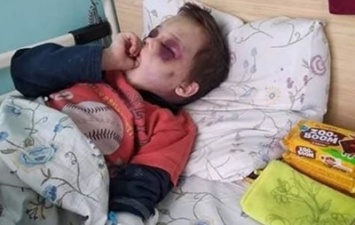В Винницкой области с побоями госпитализирован шестилетний ребенок