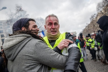 В Париже фотографу, снимавшему "желтых жилетов", из-за взрыва гранаты оторвало кисть