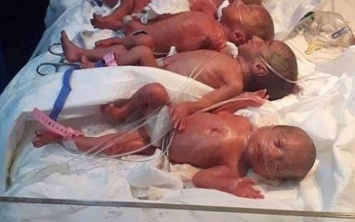 Ни один из семерых близнецов, родившихся в Ираке, не выжил