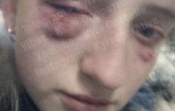 В Киеве жестоко избили школьницу