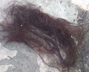Вырвали волосы: девушку жестоко избили под Харьковом (фото)