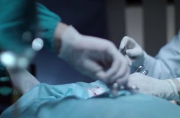 Хирурги пришили украинцу руку, которую он отрезал циркуляркой полтора месяца назад