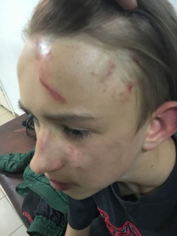 "Спасают в нейрохирургии": в Днепре взрослый вмешался в детские разборки и избил мальчика