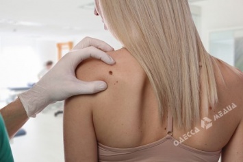 Одесситы смогут пройти бесплатную диагностику онкозаболеваний кожи