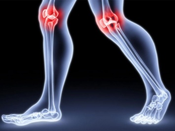 Болят суставы: причины появления артроза после 30 лет