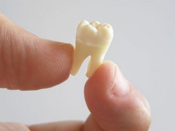 В США у младенца были обнаружены выросшие в мозге зубы