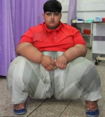 Мальчик из Пакистана стал самым толстым ребенком в мире (фото)
