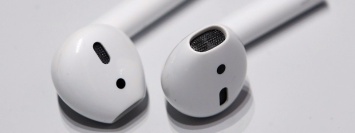 AirPods работают в желудке человека, интерактивный просмотр томографических снимков и глава Xiaomi проиграл спор на 150$ миллионов: ТОП новостей дня