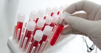 В США ученые придумали, как сдать анализ крови без ее забора