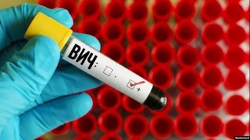 В Днепре можно будет пройти экспресс-тест на ВИЧ-инфекцию