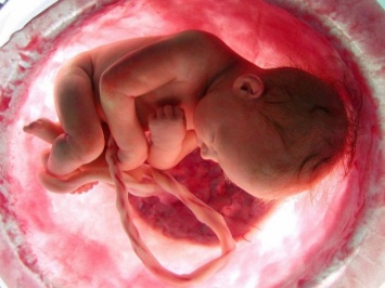 Хирурги британской Больницы Кингс-Колледж прооперировали ребенка в утробе матери