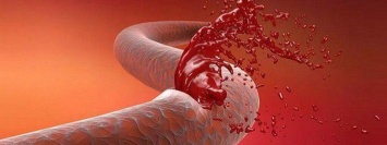 В Китае создали биоклей, который может остановить даже критическое кровотечение