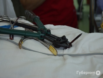 Житель Хабаровска два года прожил с гвоздем в голове, которую он мазал зеленкой