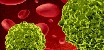 Ученые создали лазер для уничтожения раковых клеток крови