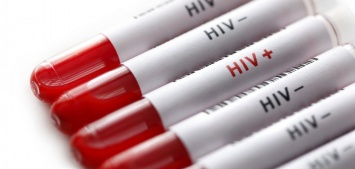 В Николаевской области потратили 48,9 тыс. грн на тесты ВИЧ (ИНФОГРАФИКА)