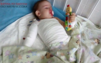 Малышка 11-ти месяцев в Одессе обварилась кипятком
