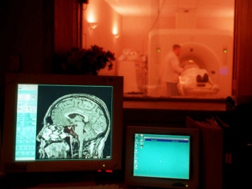 Закончено МРТ-сканирование мозга продолжительностью в 4 дня