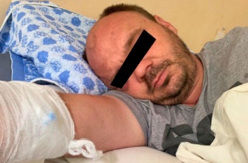 СМИ: На Одесчине муж кандидата в депутаты до полусмерти изрезал ножом человека