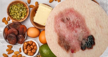 Питание, богатое витамином А, может сократить риск возникновения рака кожи, - ученые