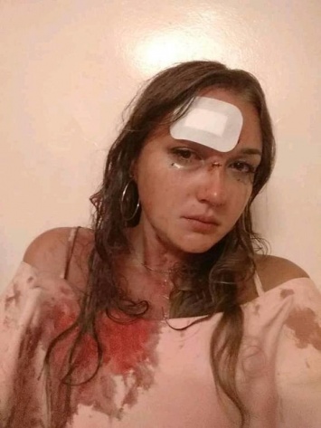 В одесском клубе "Трумен" избили девушку: администрация "отморозилась", в полиции "улыбаются"