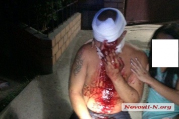 Ночная драка в Николаеве: мужчине проломили голову бутылкой