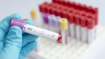 Пациент с ВИЧ впервые получил CRISPR-отредактированные клетки крови